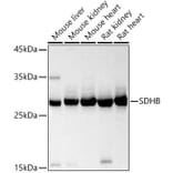 Western Blot - Anti-SDHB Antibody (A13082) - Antibodies.com