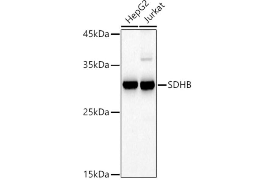 Western Blot - Anti-SDHB Antibody (A13082) - Antibodies.com