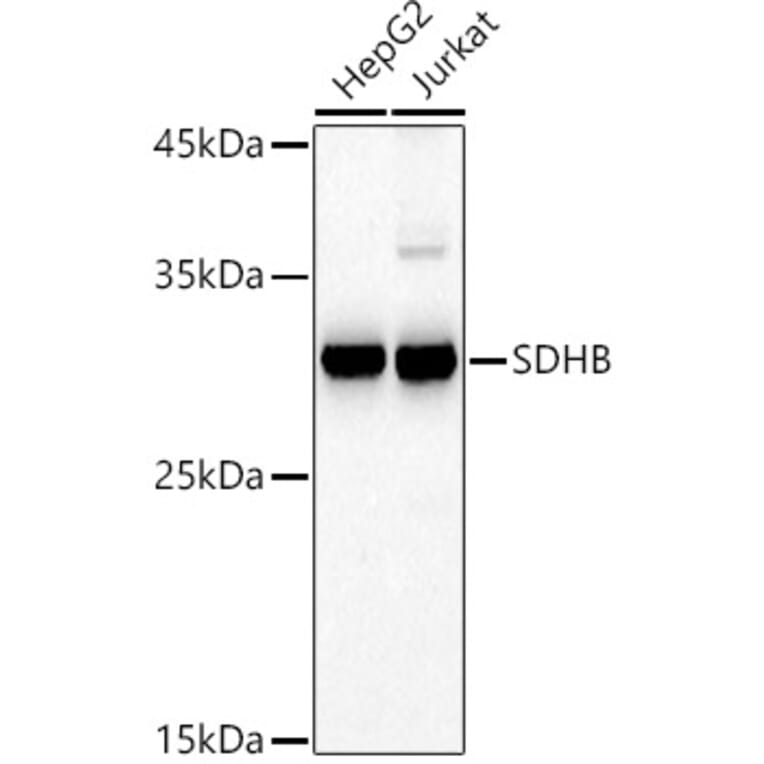 Western Blot - Anti-SDHB Antibody (A13082) - Antibodies.com