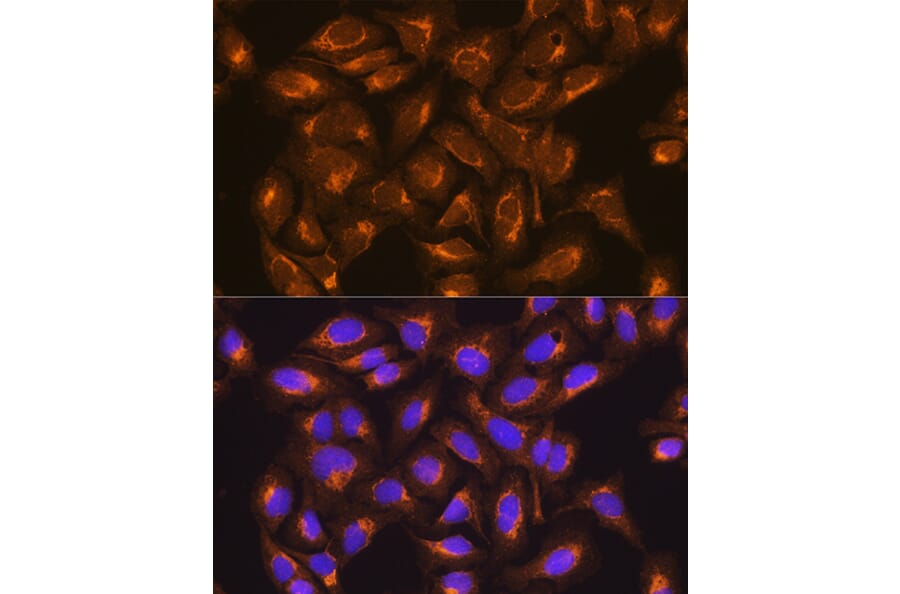 Immunofluorescence - Anti-SDHB Antibody (A13082) - Antibodies.com