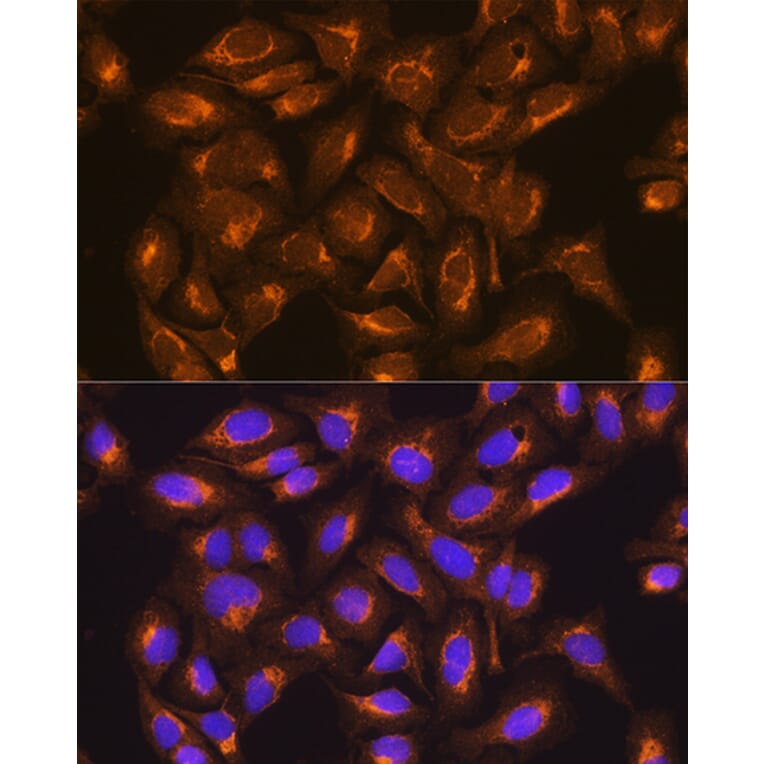 Immunofluorescence - Anti-SDHB Antibody (A13082) - Antibodies.com