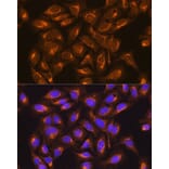 Immunofluorescence - Anti-SDHB Antibody (A13082) - Antibodies.com