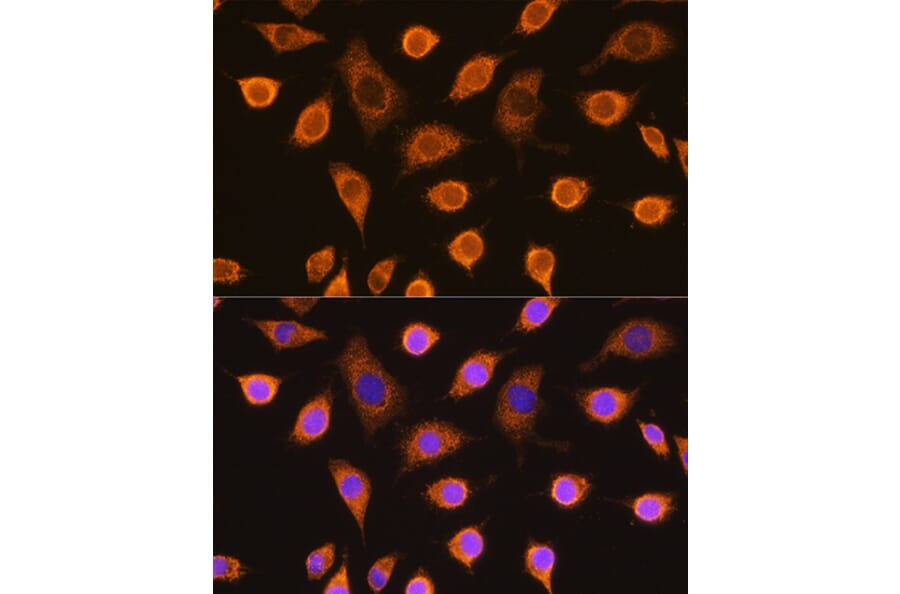 Immunofluorescence - Anti-SDHB Antibody (A13082) - Antibodies.com