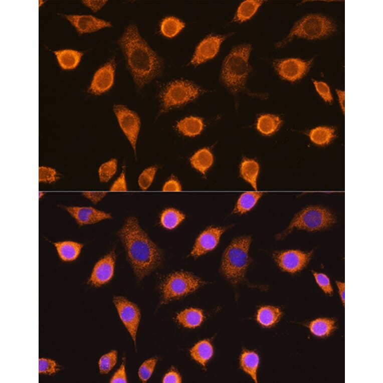 Immunofluorescence - Anti-SDHB Antibody (A13082) - Antibodies.com