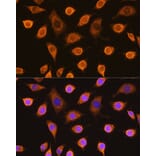 Immunofluorescence - Anti-SDHB Antibody (A13082) - Antibodies.com