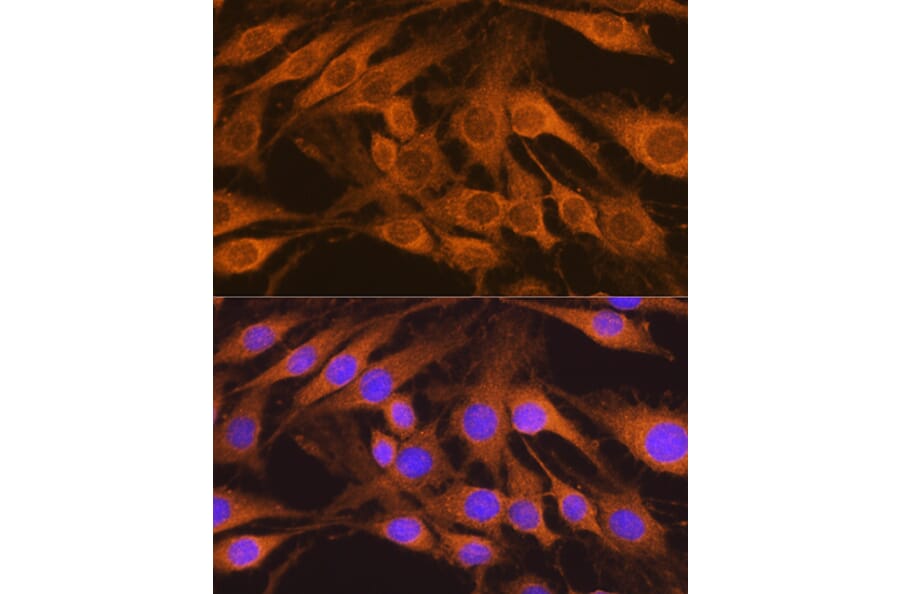 Immunofluorescence - Anti-SDHB Antibody (A13082) - Antibodies.com