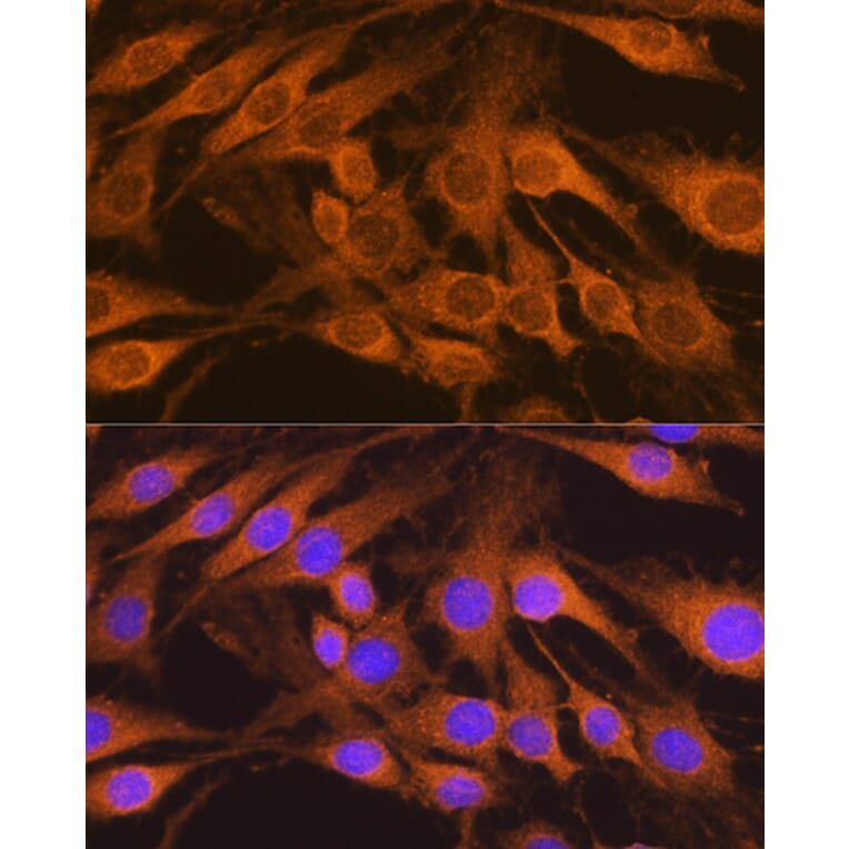 Immunofluorescence - Anti-SDHB Antibody (A13082) - Antibodies.com