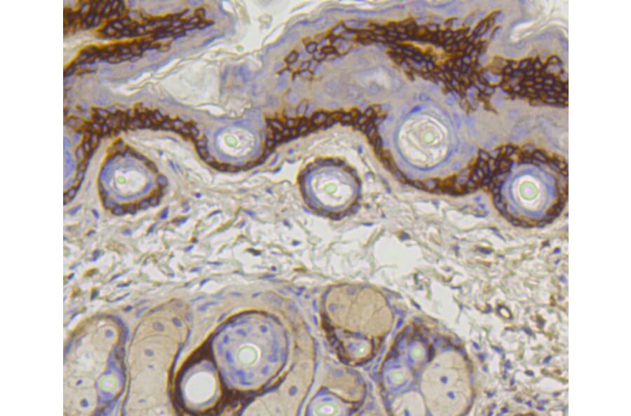 Immunohistochemistry - Anti-COL17A1 Antibody (A10823) - Antibodies.com