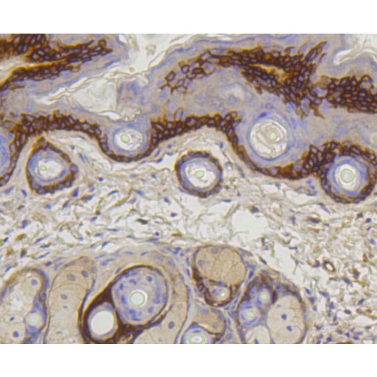 Immunohistochemistry - Anti-COL17A1 Antibody (A10823) - Antibodies.com