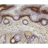 Immunohistochemistry - Anti-COL17A1 Antibody (A10823) - Antibodies.com