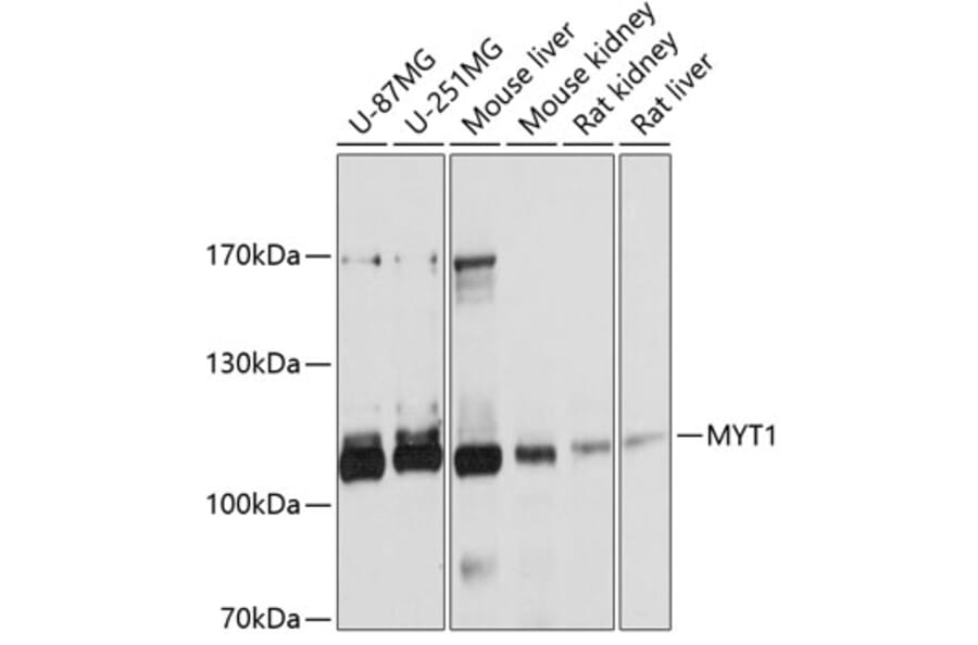 Western Blot - Anti-Myt1/MTF1 Antibody (A13084) - Antibodies.com