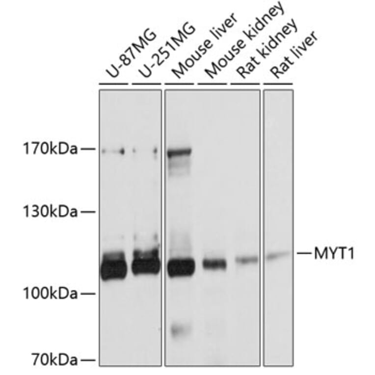Western Blot - Anti-Myt1/MTF1 Antibody (A13084) - Antibodies.com