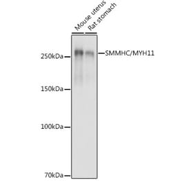 Western Blot - Anti-smooth muscle Myosin heavy chain 11 Antibody (A13086) - Antibodies.com