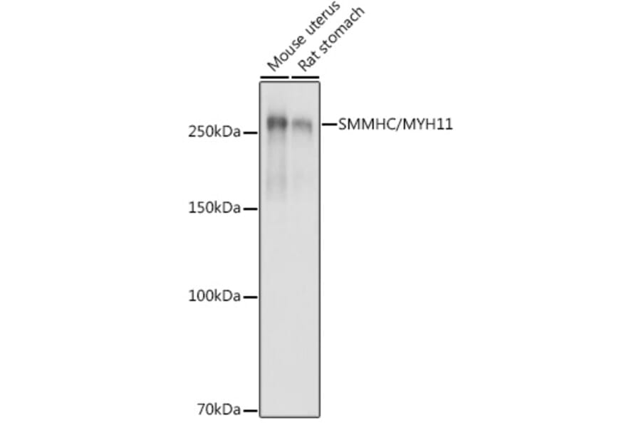 Western Blot - Anti-smooth muscle Myosin heavy chain 11 Antibody (A13086) - Antibodies.com