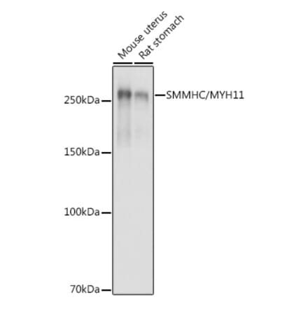 Western Blot - Anti-smooth muscle Myosin heavy chain 11 Antibody (A13086) - Antibodies.com