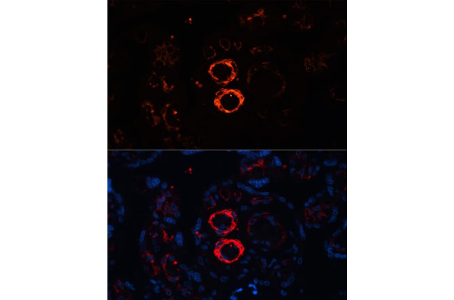 Immunofluorescence - Anti-smooth muscle Myosin heavy chain 11 Antibody (A13086) - Antibodies.com