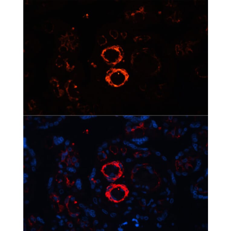 Immunofluorescence - Anti-smooth muscle Myosin heavy chain 11 Antibody (A13086) - Antibodies.com