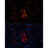 Immunofluorescence - Anti-smooth muscle Myosin heavy chain 11 Antibody (A13086) - Antibodies.com