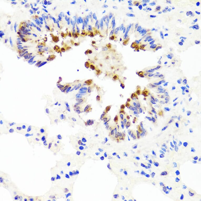 Immunohistochemistry - Anti-AMBRA1 Antibody (A13088) - Antibodies.com