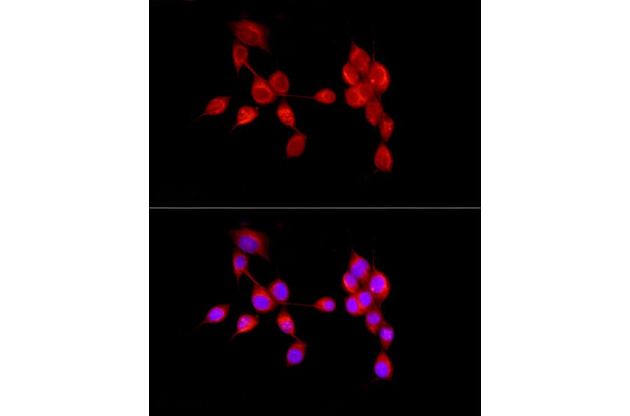 Immunofluorescence - Anti-AMBRA1 Antibody (A13088) - Antibodies.com