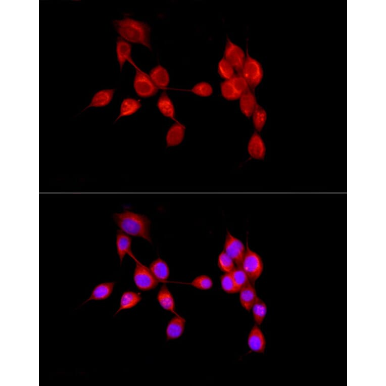 Immunofluorescence - Anti-AMBRA1 Antibody (A13088) - Antibodies.com