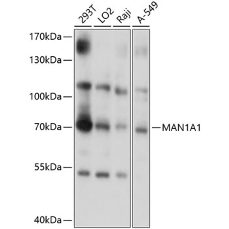 Western Blot - Anti-alpha 1,2 Mannosidase IA/MAN1A1 Antibody (A13089) - Antibodies.com