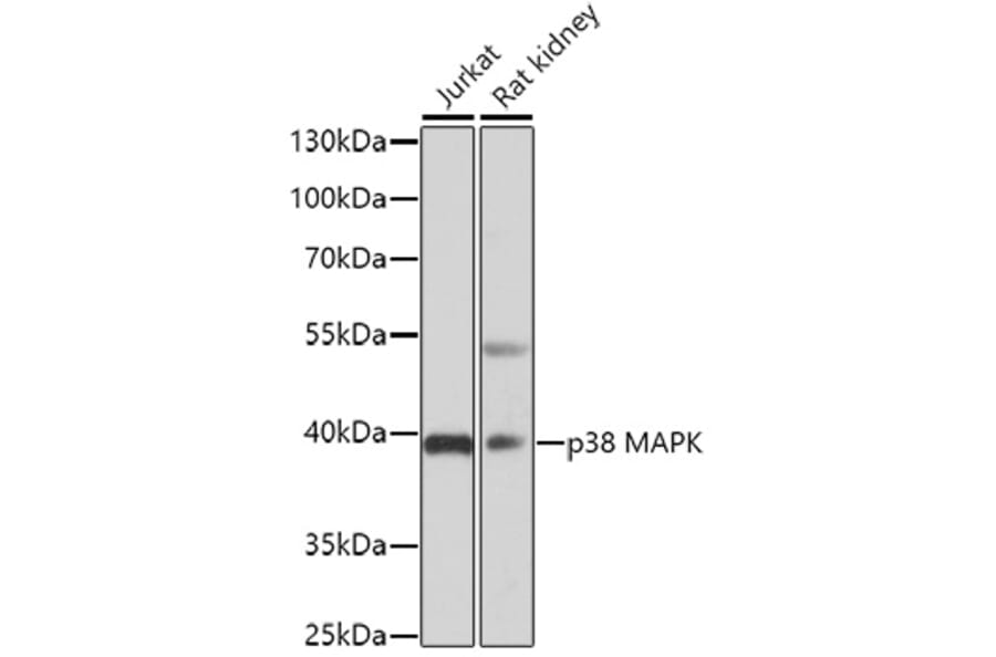 Western Blot - Anti-p38 alpha / MAPK14 Antibody (A13090) - Antibodies.com