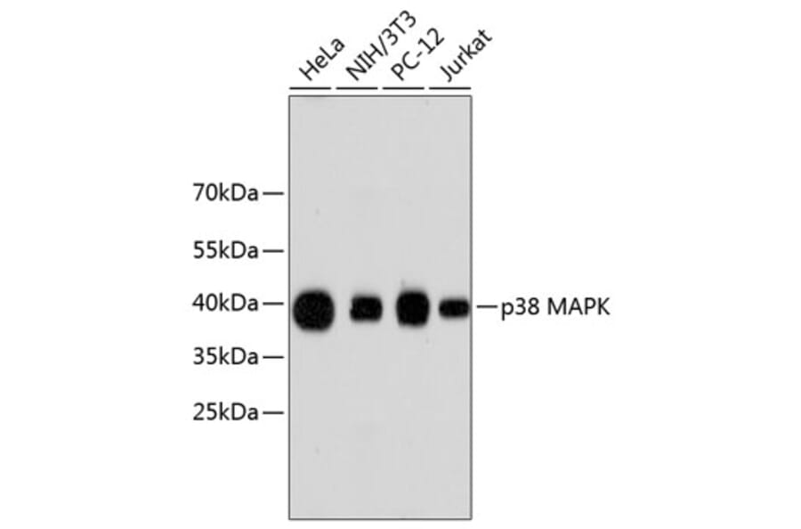 Western Blot - Anti-p38 alpha / MAPK14 Antibody (A13090) - Antibodies.com