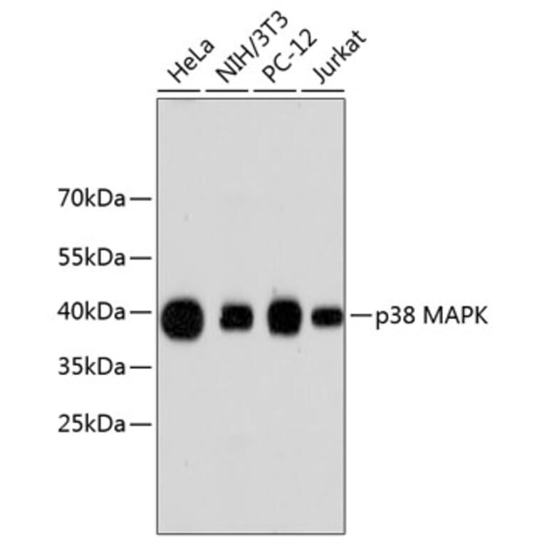 Western Blot - Anti-p38 alpha / MAPK14 Antibody (A13090) - Antibodies.com
