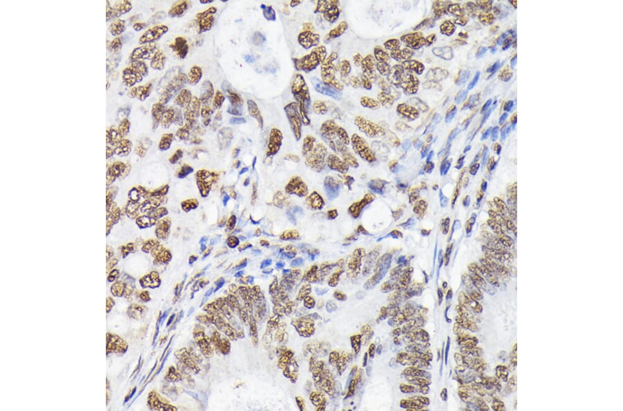 Immunohistochemistry - Anti-p38 alpha / MAPK14 Antibody (A13090) - Antibodies.com