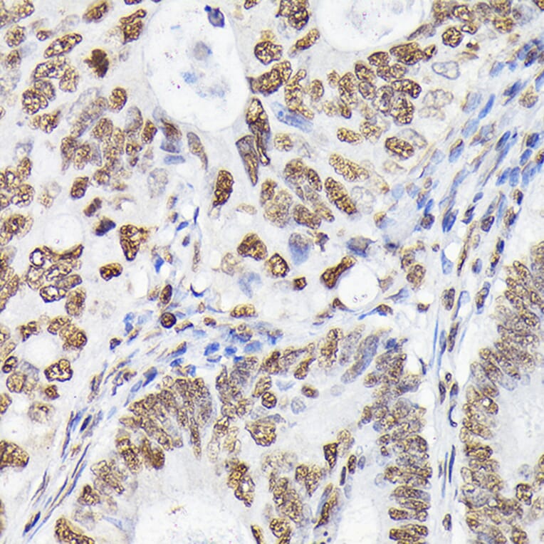Immunohistochemistry - Anti-p38 alpha / MAPK14 Antibody (A13090) - Antibodies.com