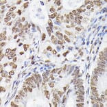 Immunohistochemistry - Anti-p38 alpha / MAPK14 Antibody (A13090) - Antibodies.com