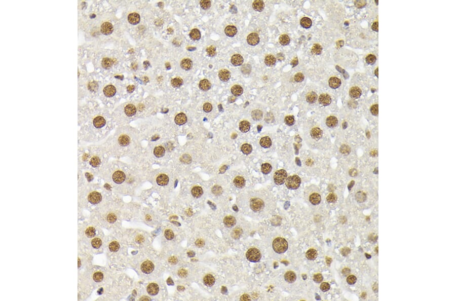 Immunohistochemistry - Anti-p38 alpha / MAPK14 Antibody (A13090) - Antibodies.com