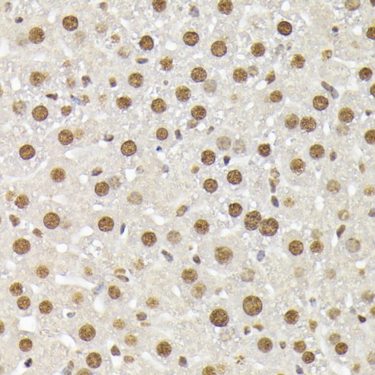 Immunohistochemistry - Anti-p38 alpha / MAPK14 Antibody (A13090) - Antibodies.com