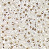Immunohistochemistry - Anti-p38 alpha / MAPK14 Antibody (A13090) - Antibodies.com