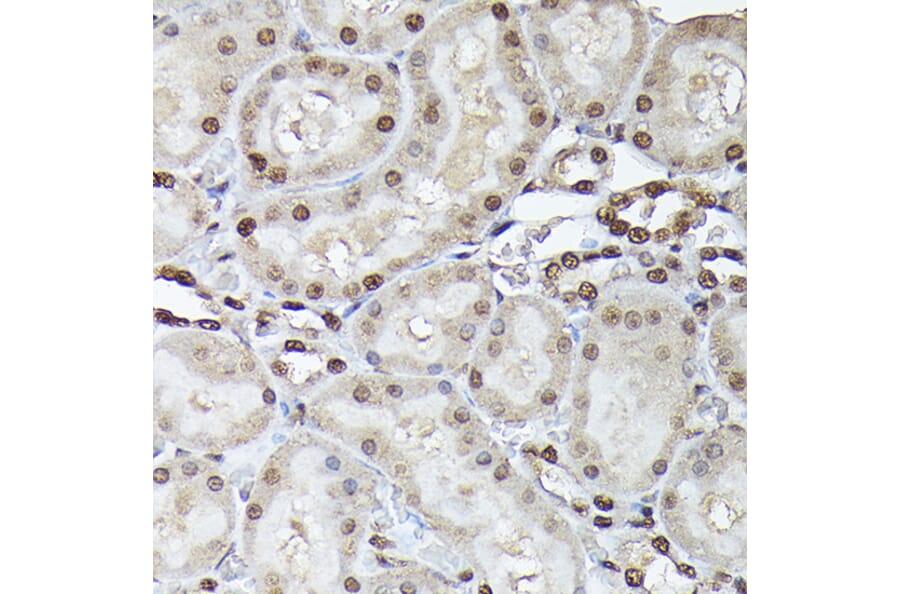 Immunohistochemistry - Anti-p38 alpha / MAPK14 Antibody (A13090) - Antibodies.com