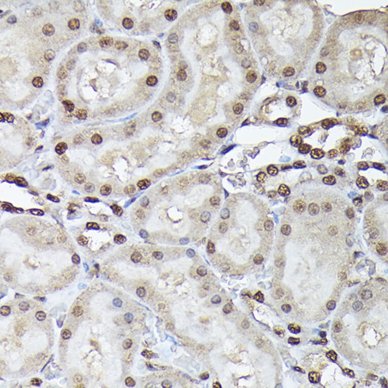 Immunohistochemistry - Anti-p38 alpha / MAPK14 Antibody (A13090) - Antibodies.com