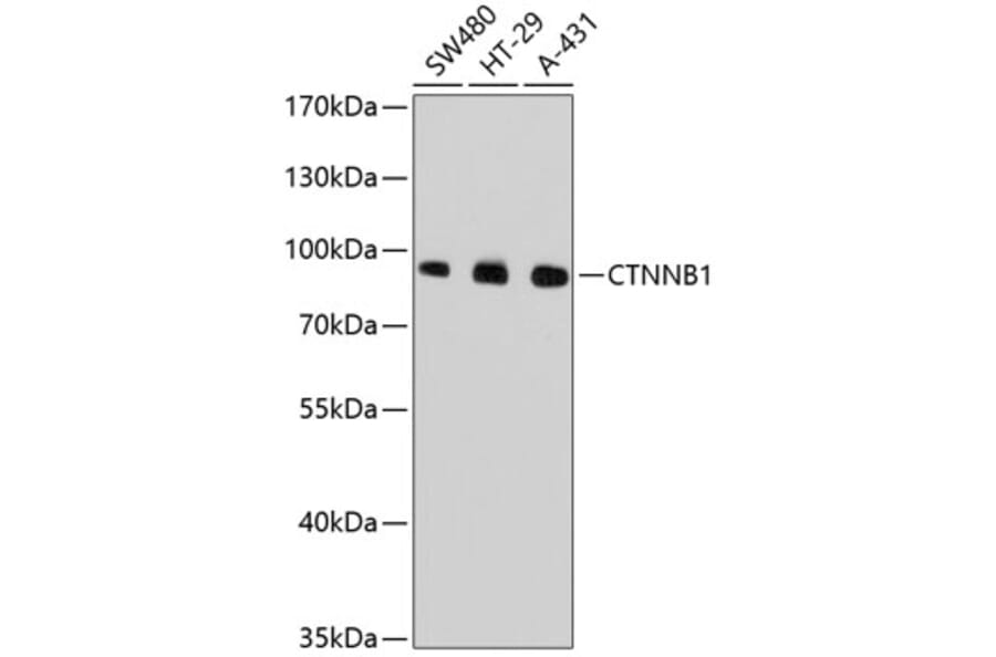 Western Blot - Anti-CTNNB1 Antibody (A10834) - Antibodies.com