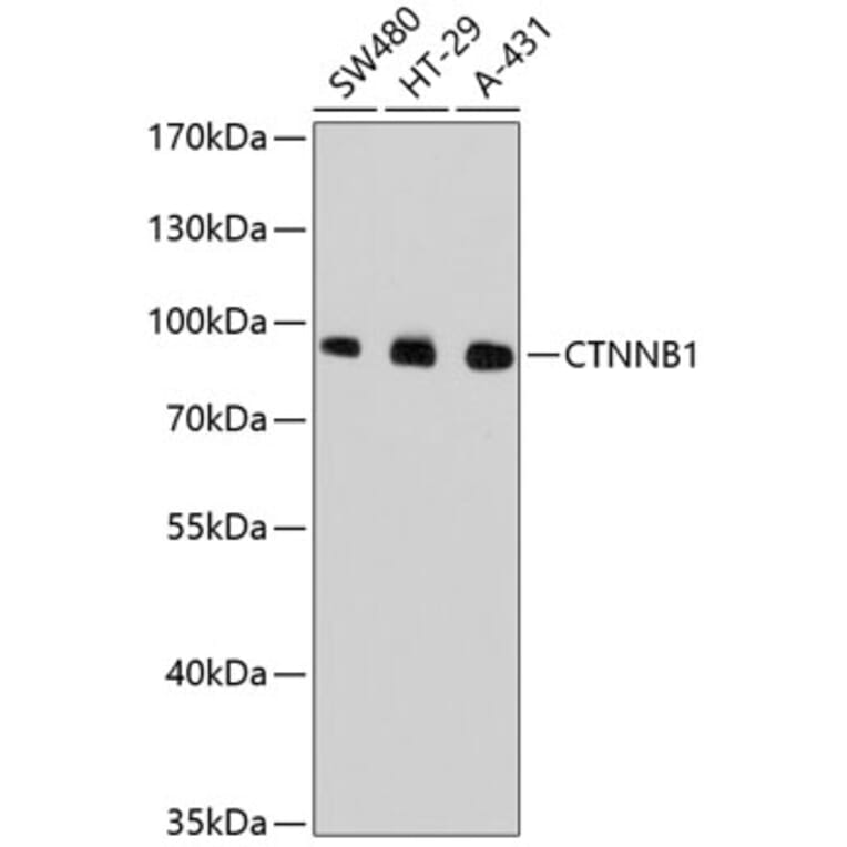 Western Blot - Anti-CTNNB1 Antibody (A10834) - Antibodies.com