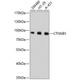 Western Blot - Anti-CTNNB1 Antibody (A10834) - Antibodies.com