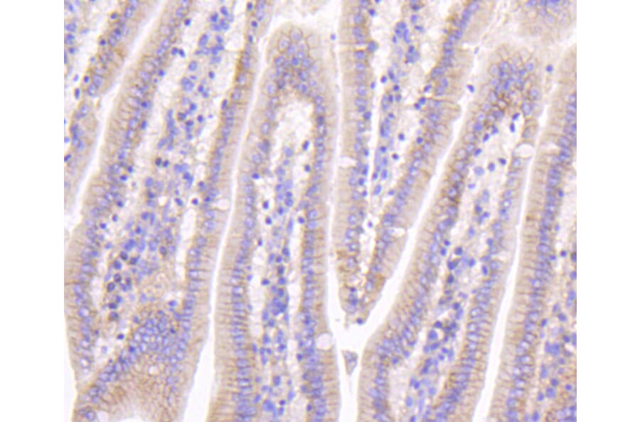 Immunohistochemistry - Anti-CTNNB1 Antibody (A10834) - Antibodies.com