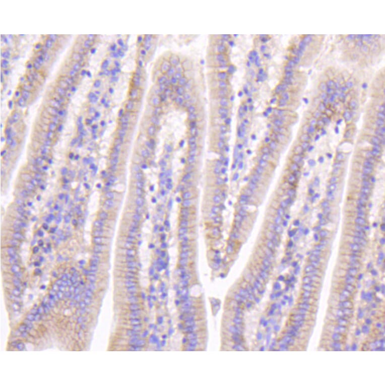 Immunohistochemistry - Anti-CTNNB1 Antibody (A10834) - Antibodies.com