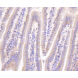 Immunohistochemistry - Anti-CTNNB1 Antibody (A10834) - Antibodies.com