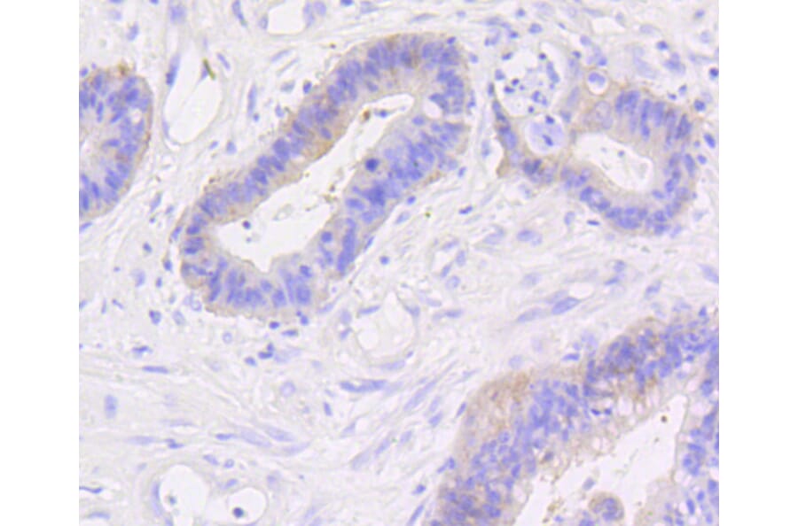 Immunohistochemistry - Anti-CTNNB1 Antibody (A10834) - Antibodies.com