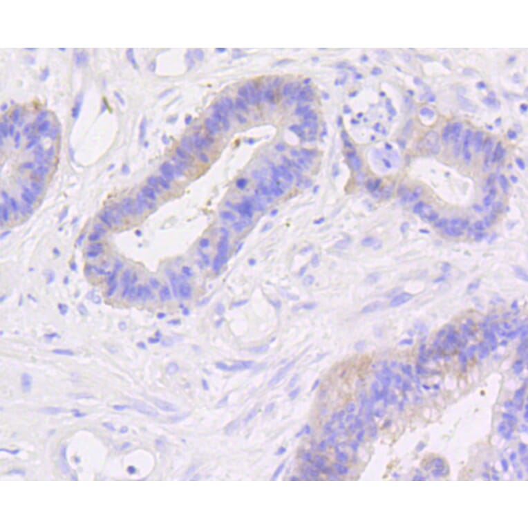 Immunohistochemistry - Anti-CTNNB1 Antibody (A10834) - Antibodies.com