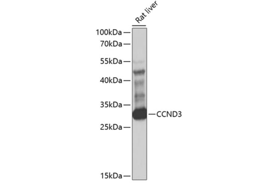 Western Blot - Anti-CCND3 Antibody (A1084) - Antibodies.com