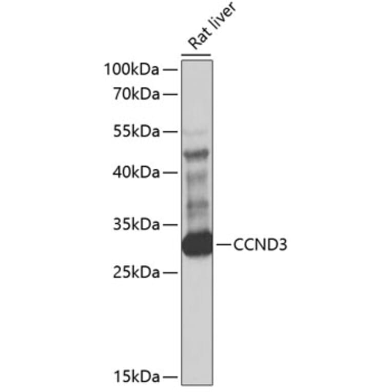 Western Blot - Anti-CCND3 Antibody (A1084) - Antibodies.com
