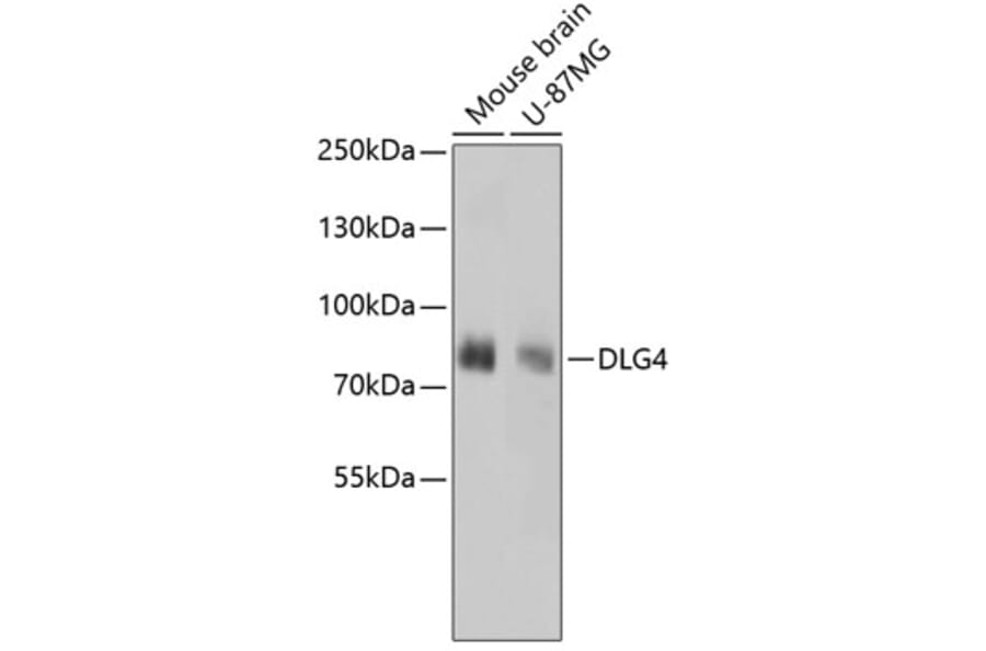 Western Blot - Anti-DLG4 Antibody (A10841) - Antibodies.com