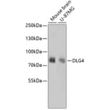 Western Blot - Anti-DLG4 Antibody (A10841) - Antibodies.com