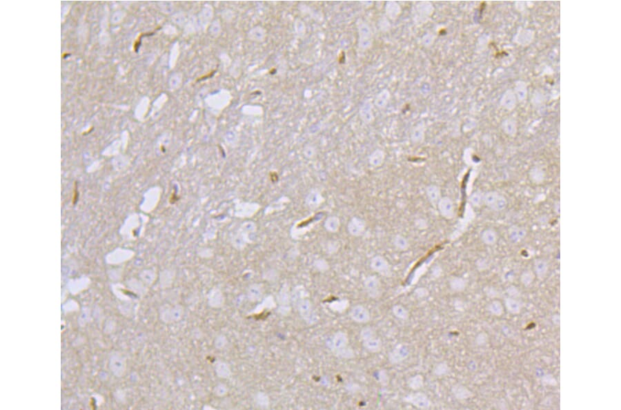 Immunohistochemistry - Anti-DLG4 Antibody (A10841) - Antibodies.com